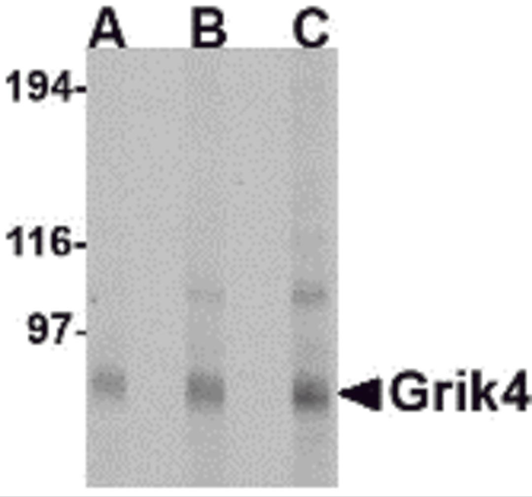 Western blot analysis of Grik4 in Rat brain tissue lysate with Grik4 antibody at (A) 0.5, (B) 1 and (C) 2 μg/mL.