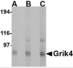 Western blot analysis of Grik4 in Rat brain tissue lysate with Grik4 antibody at (A) 0.5, (B) 1 and (C) 2 μg/mL.