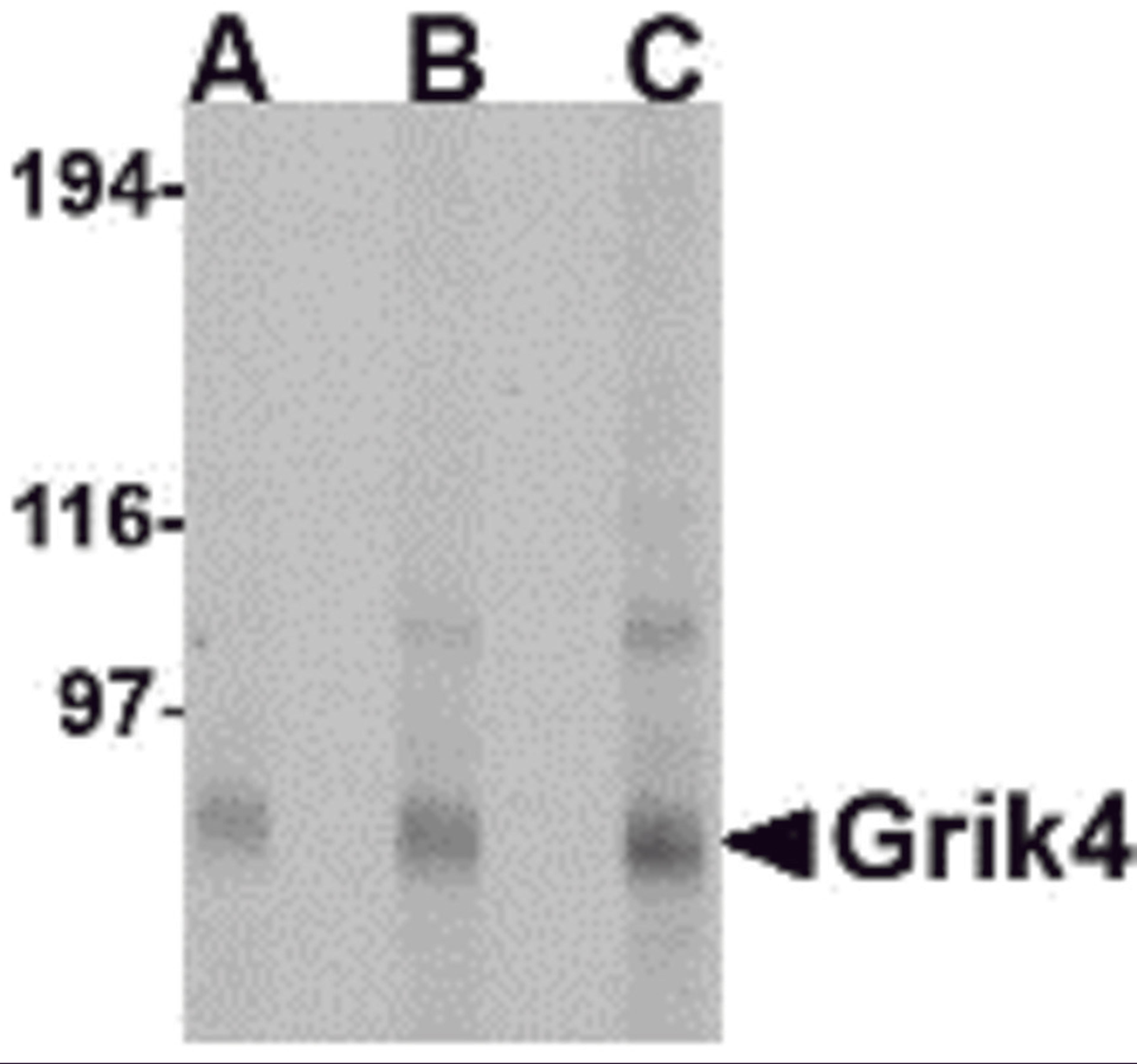 Western blot analysis of Grik4 in Rat brain tissue lysate with Grik4 antibody at (A) 0.5, (B) 1 and (C) 2 μg/mL.