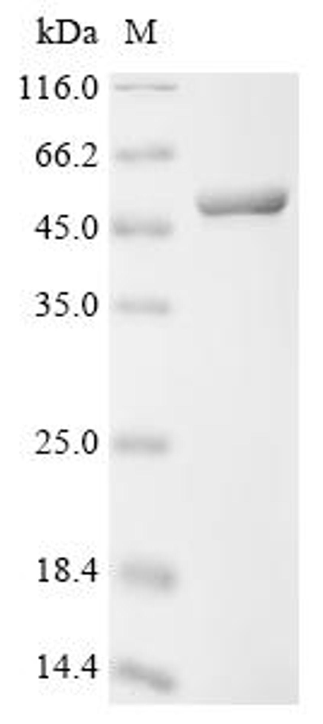 (Tris-Glycine gel) Discontinuous SDS-PAGE (reduced) with 5% enrichment gel and 15% separation gel.