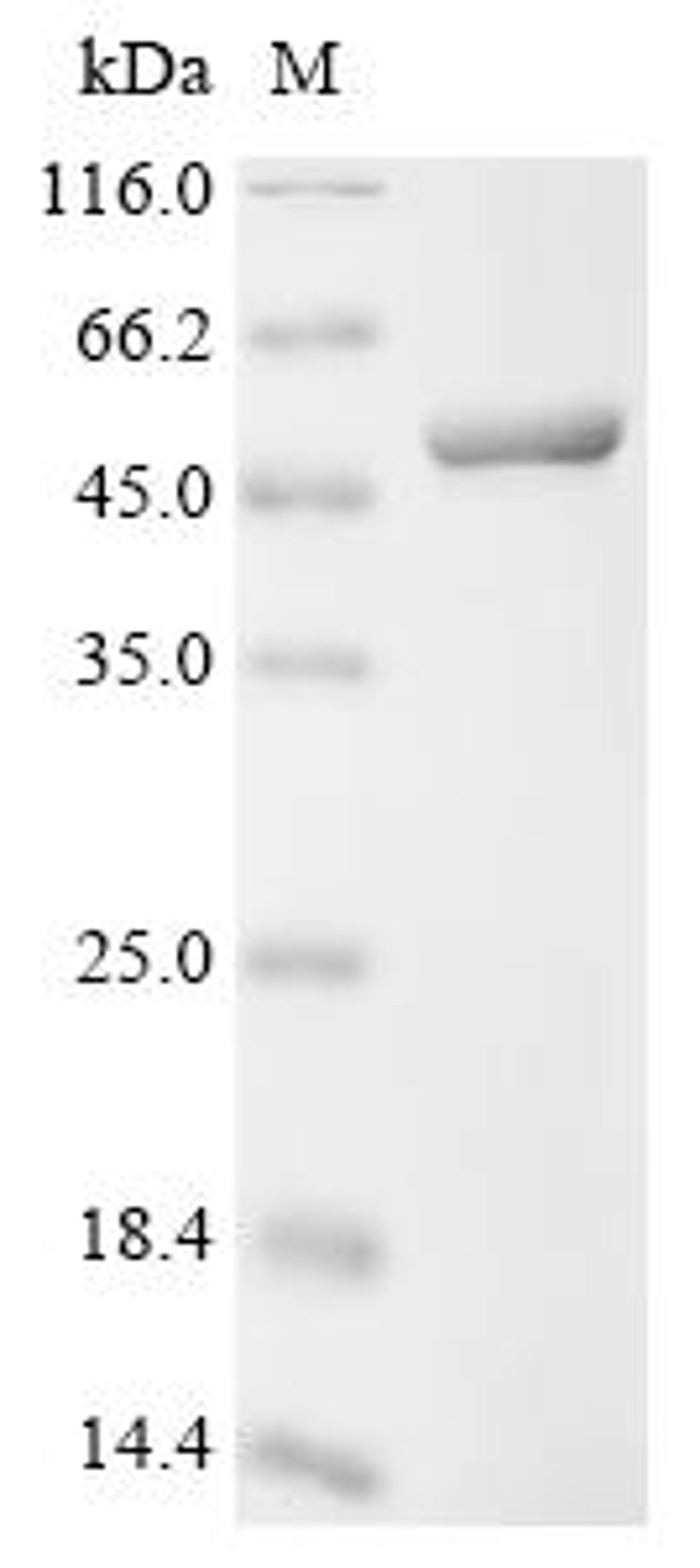 (Tris-Glycine gel) Discontinuous SDS-PAGE (reduced) with 5% enrichment gel and 15% separation gel.