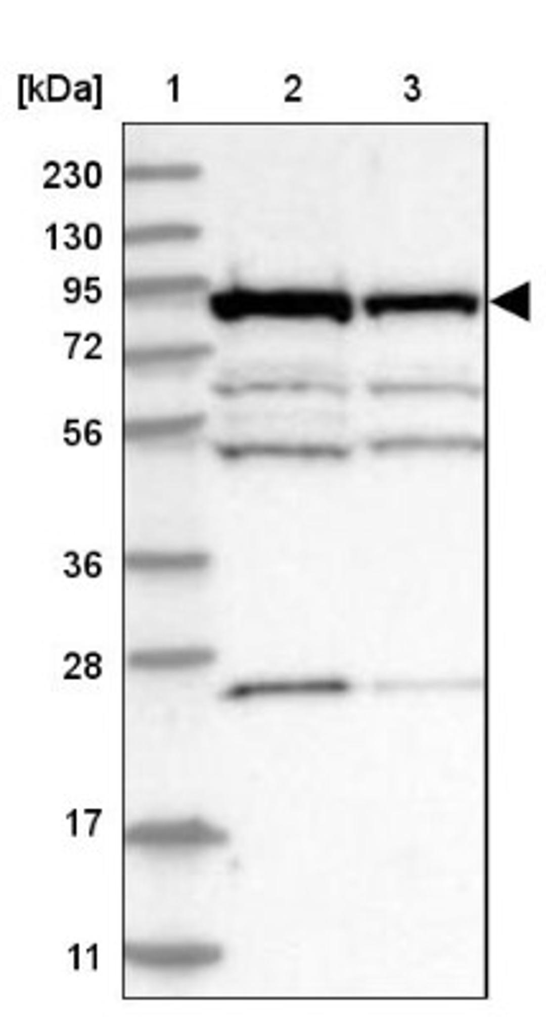 Western Blot: ANKZF1 Antibody [NBP1-84627] - Lane 1: Marker [kDa] 230, 130, 95, 72, 56, 36, 28, 17, 11<br/>Lane 2: Human cell line RT-4<br/>Lane 3: Human cell line U-251MG sp