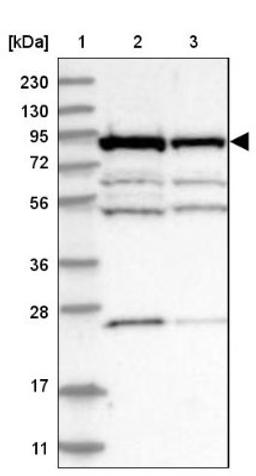 Western Blot: ANKZF1 Antibody [NBP1-84627] - Lane 1: Marker [kDa] 230, 130, 95, 72, 56, 36, 28, 17, 11<br/>Lane 2: Human cell line RT-4<br/>Lane 3: Human cell line U-251MG sp