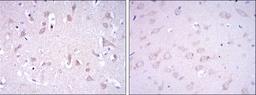 Immunohistochemistry: Glutamate Receptor 3 Antibody (1D2) [NBP2-37584] - Immunohistochemical analysis of paraffin-embedded human brain tissues (left) and rat brain tissues (right) using GRIA3 mouse mAb with DAB staining.