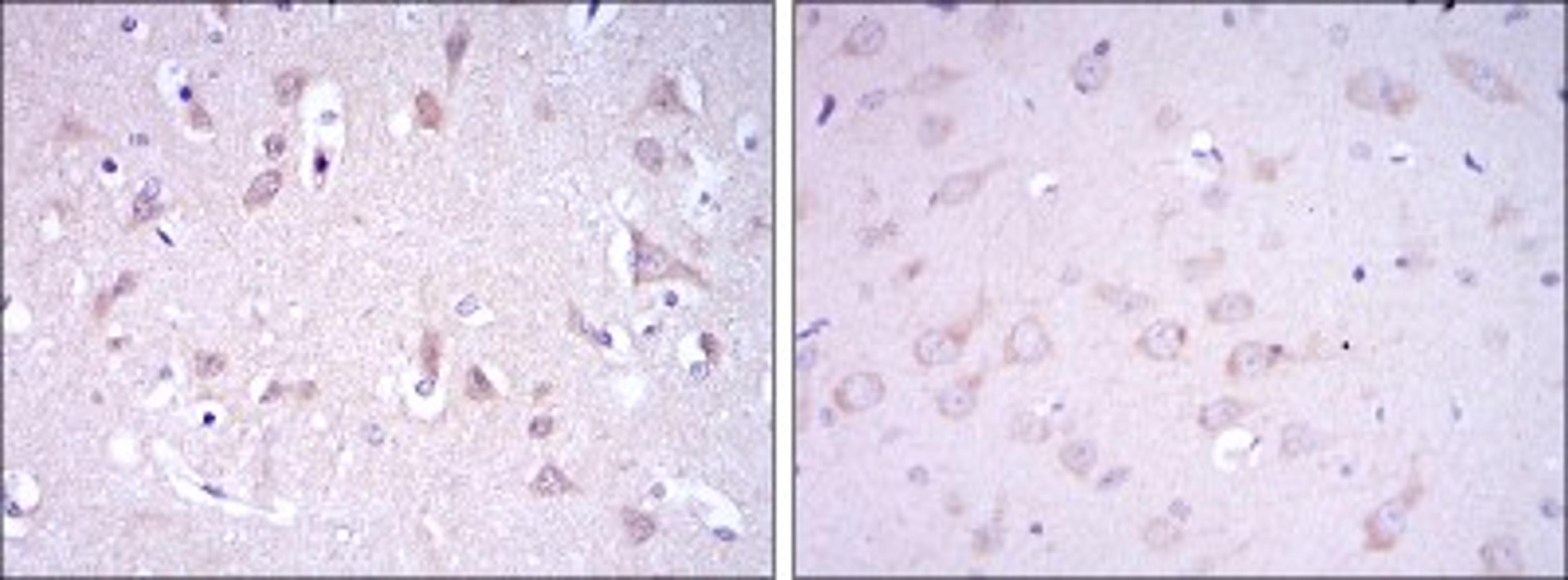 Immunohistochemistry: Glutamate Receptor 3 Antibody (1D2) [NBP2-37584] - Immunohistochemical analysis of paraffin-embedded human brain tissues (left) and rat brain tissues (right) using GRIA3 mouse mAb with DAB staining.