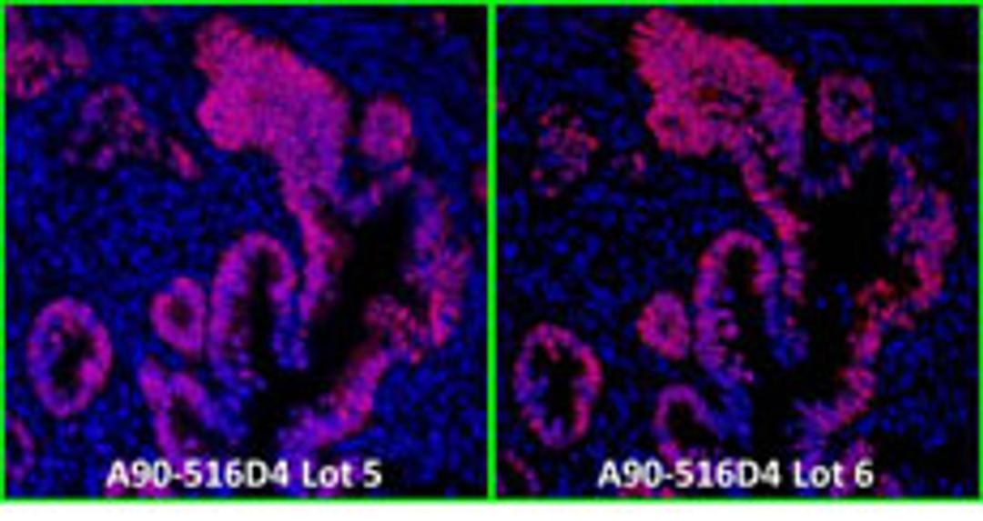 Detection of human p53 by immunofluorescence.