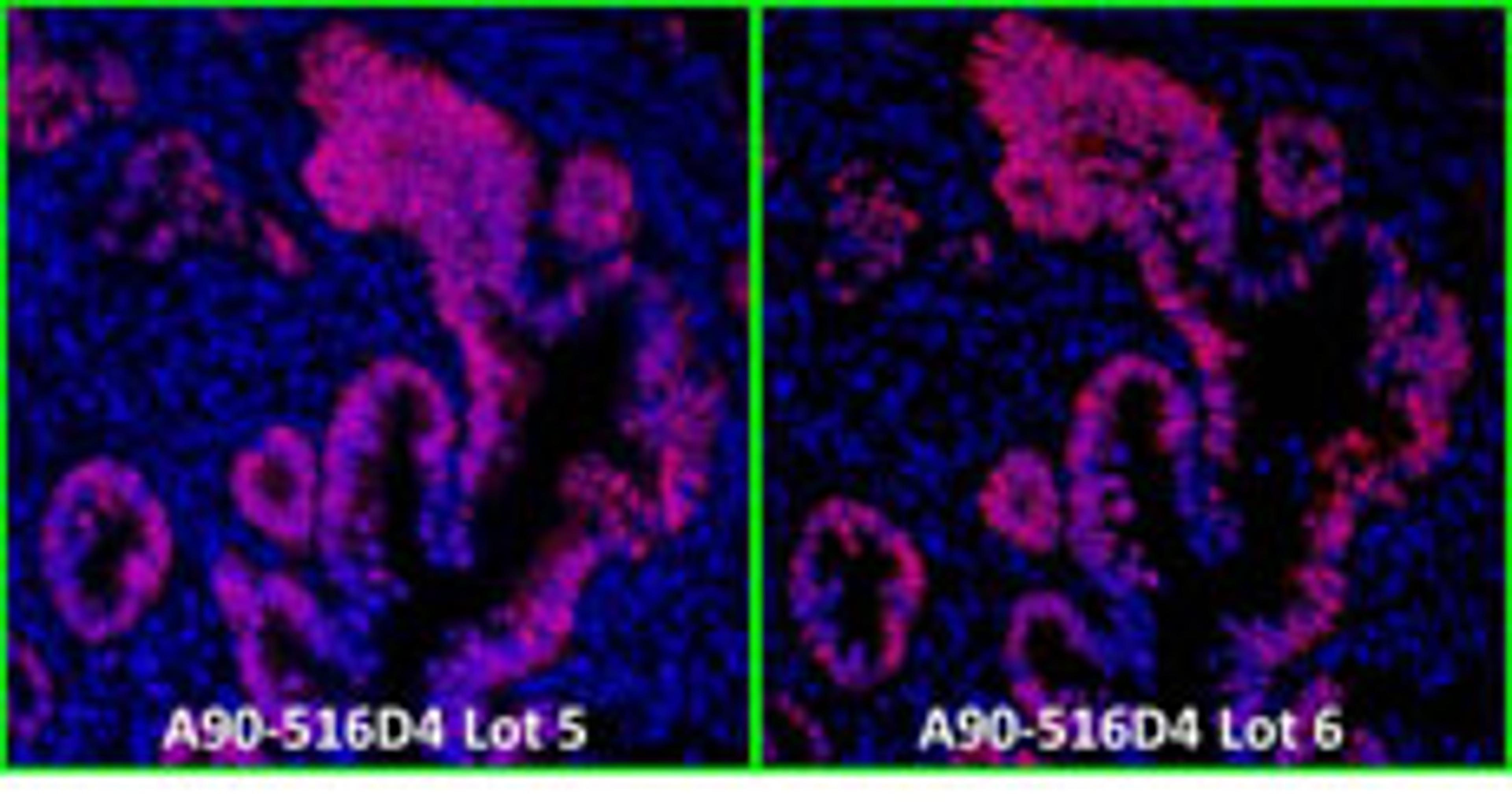 Detection of human p53 by immunofluorescence.