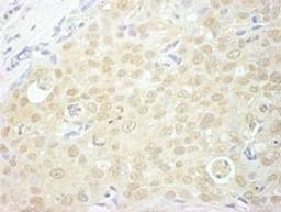 Detection of human NCBP1/CBP80 by immunohistochemistry.