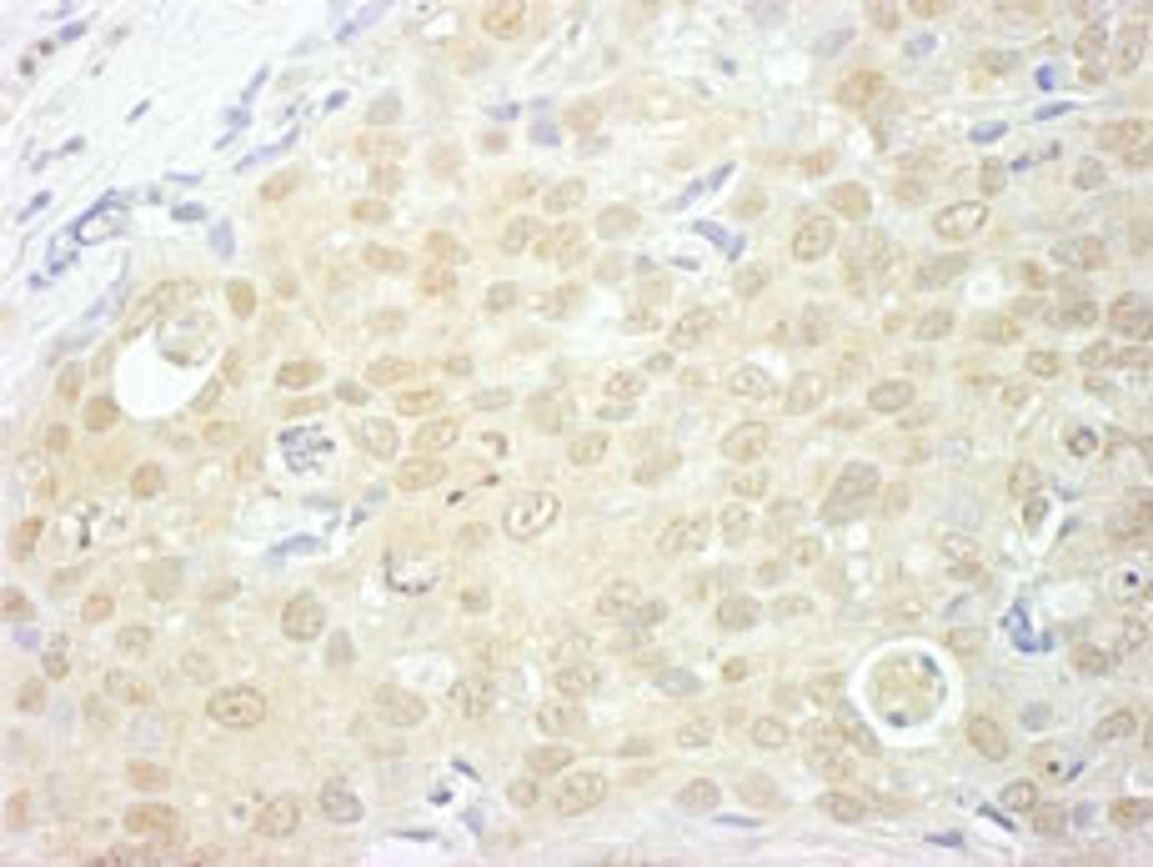 Detection of human NCBP1/CBP80 by immunohistochemistry.