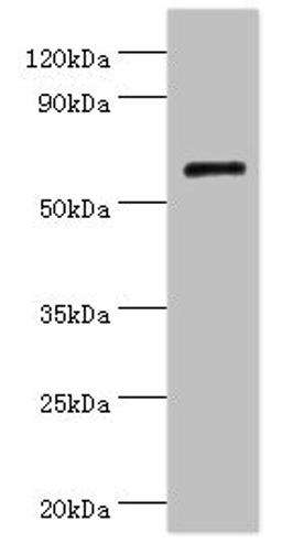 Western blot. All lanes: COL10A1 antibody at 4µg/ml + K562 whole cell lysate. Secondary. Goat polyclonal to rabbit IgG at 1/10000 dilution. Predicted band size: 66 kDa. Observed band size: 66 kDa