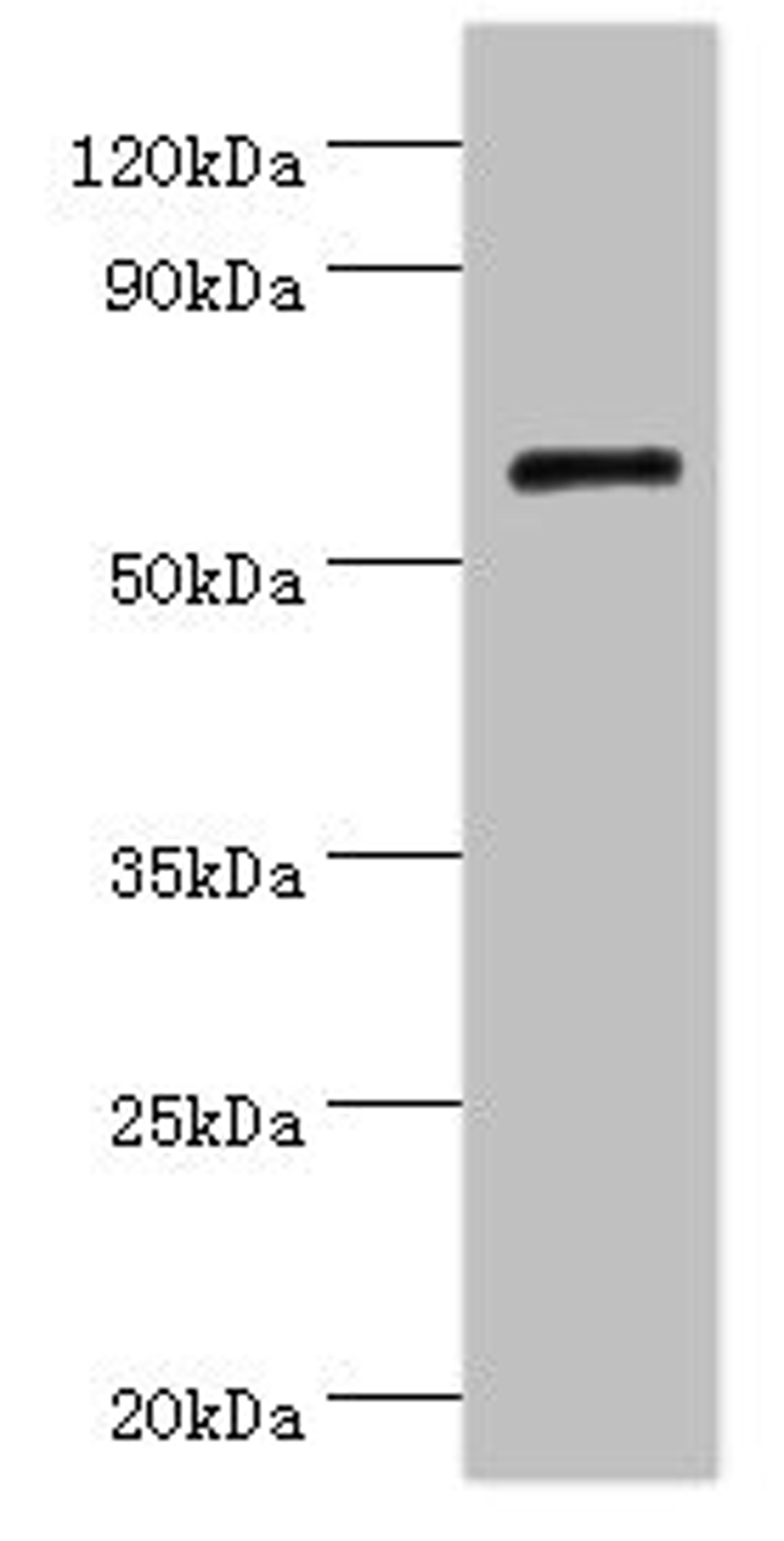 Western blot. All lanes: COL10A1 antibody at 4µg/ml + K562 whole cell lysate. Secondary. Goat polyclonal to rabbit IgG at 1/10000 dilution. Predicted band size: 66 kDa. Observed band size: 66 kDa