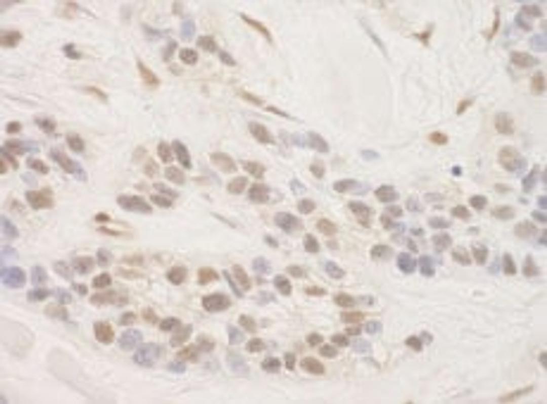 Detection of human TORC3 by immunohistochemistry.