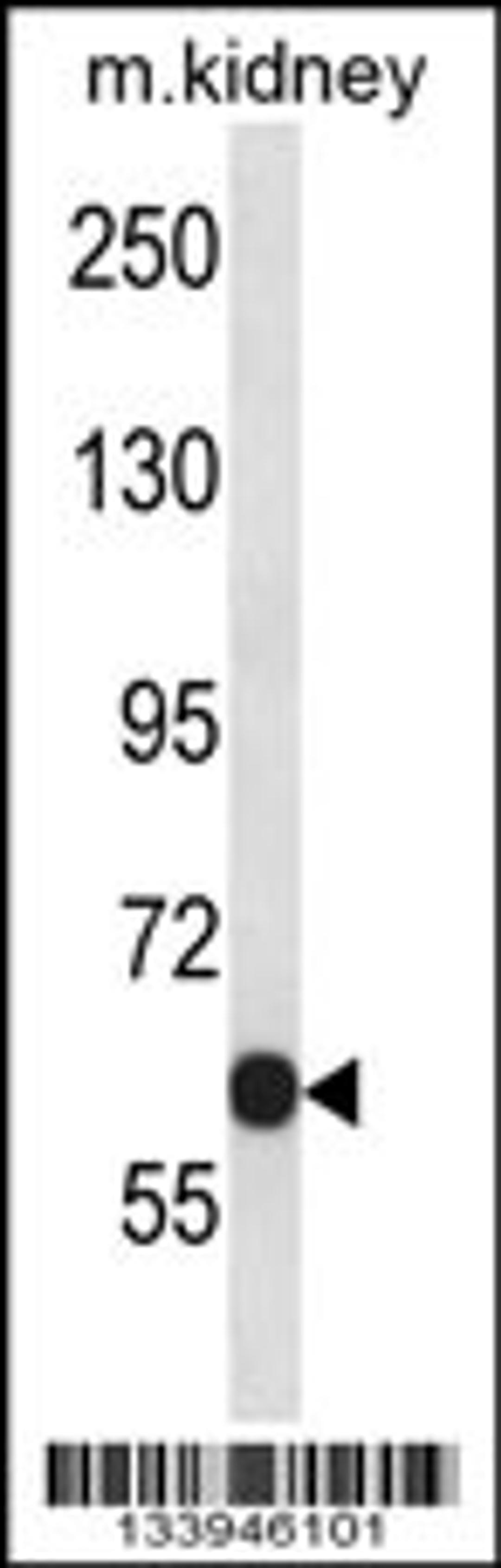 Western blot analysis in mouse kidney tissue lysates (35ug/lane).