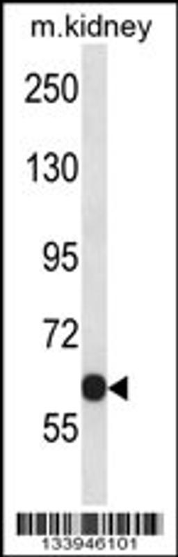 Western blot analysis in mouse kidney tissue lysates (35ug/lane).