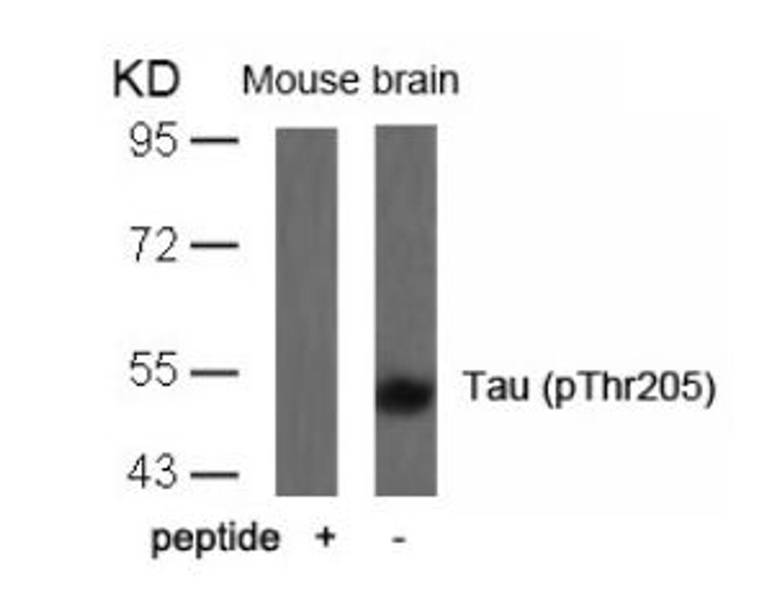 Western blot analysis of lysed extracts from mouse brain tissue using Tau (Phospho-Thr205).