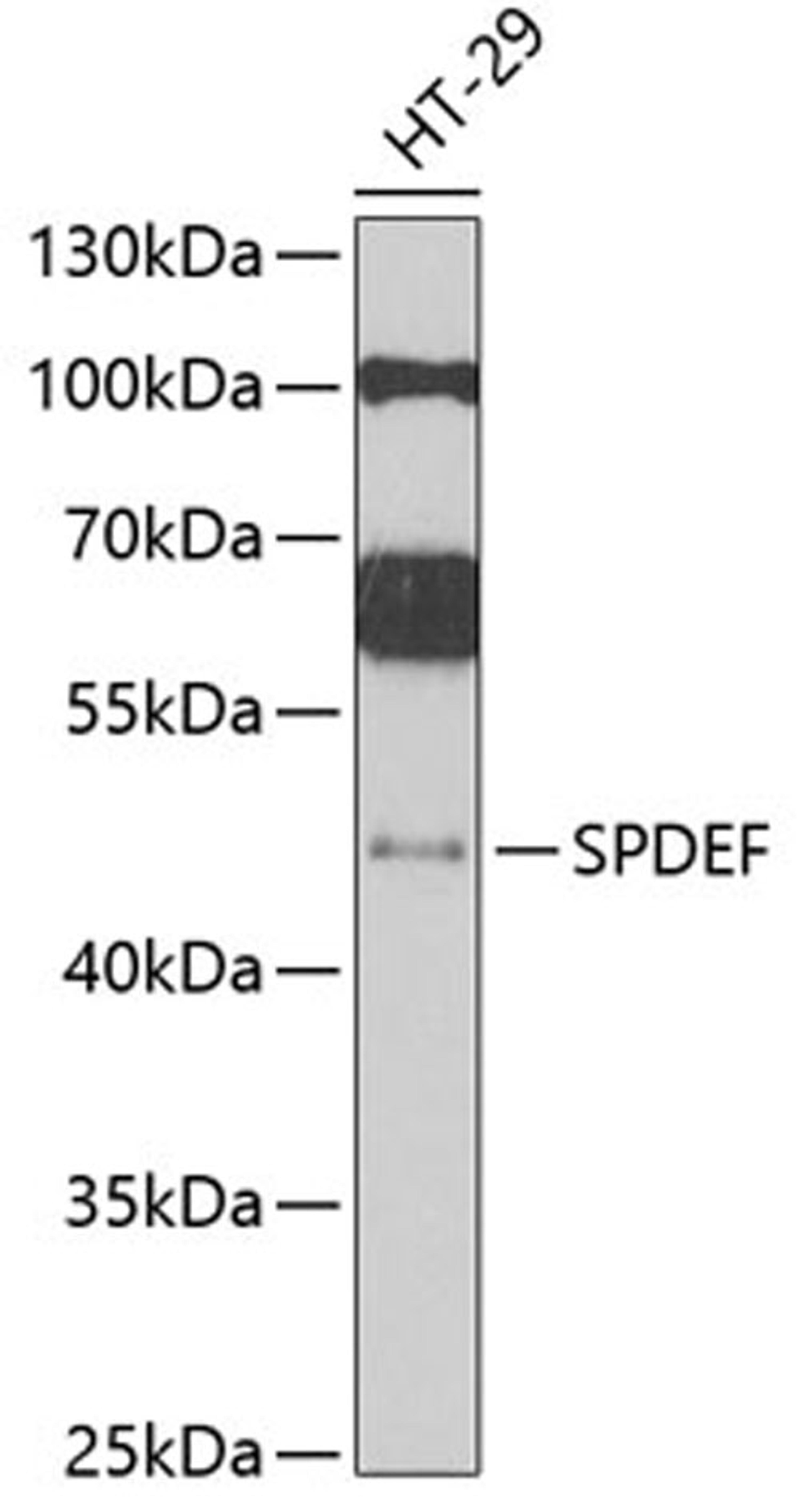 Western blot - SPDEF antibody (A6747)