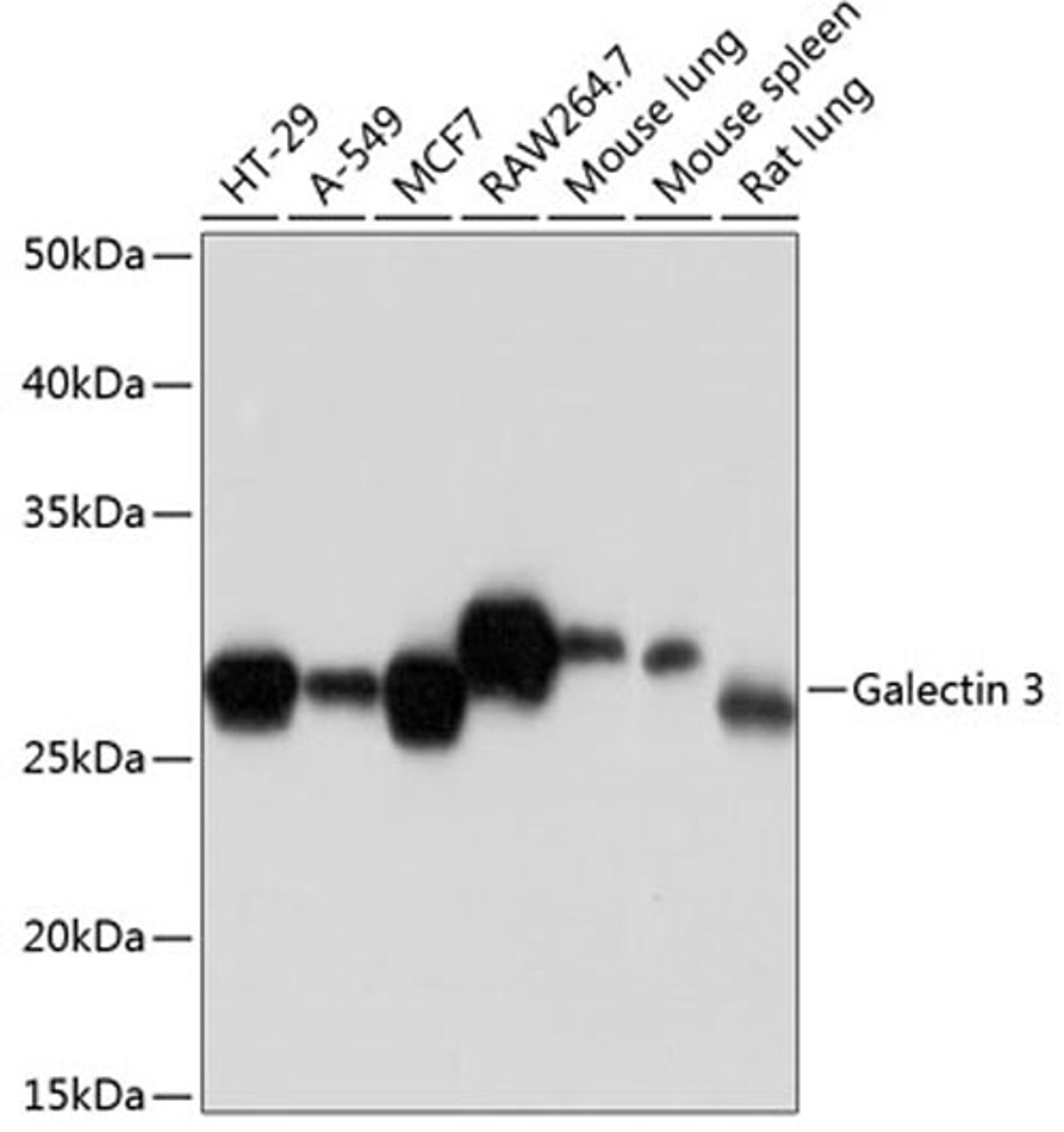 Western blot - Galectin 3 Rabbit mAb (A11198)