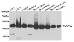 Western blot analysis of extract of various cells using UQCRC2 antibody