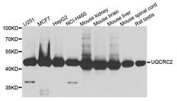 Western blot analysis of extract of various cells using UQCRC2 antibody