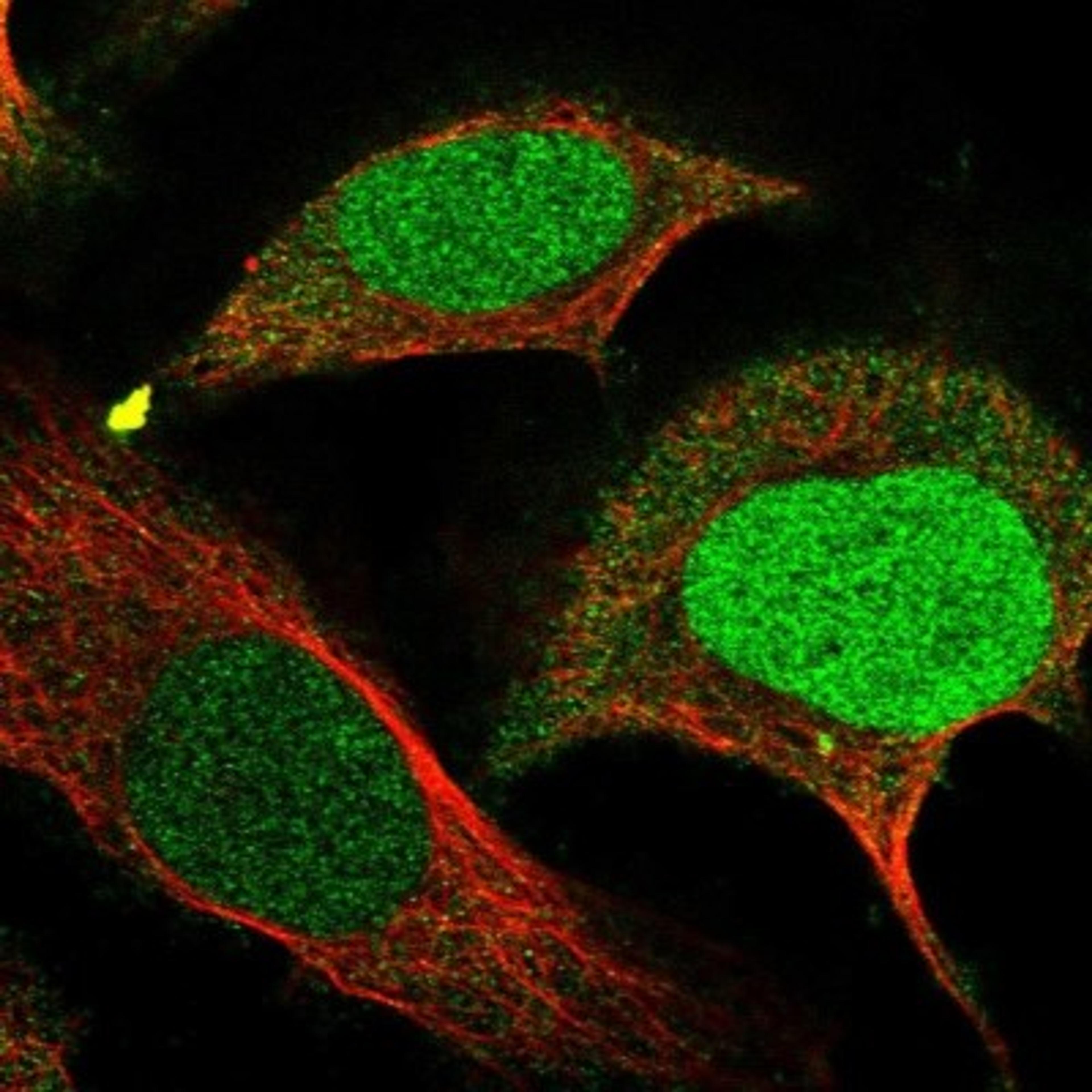 Immunocytochemistry/Immunofluorescence: FAM111B Antibody [NBP1-86645] - Immunofluorescent staining of human cell line U-2 OS shows positivity in nucleus & cytoplasm.