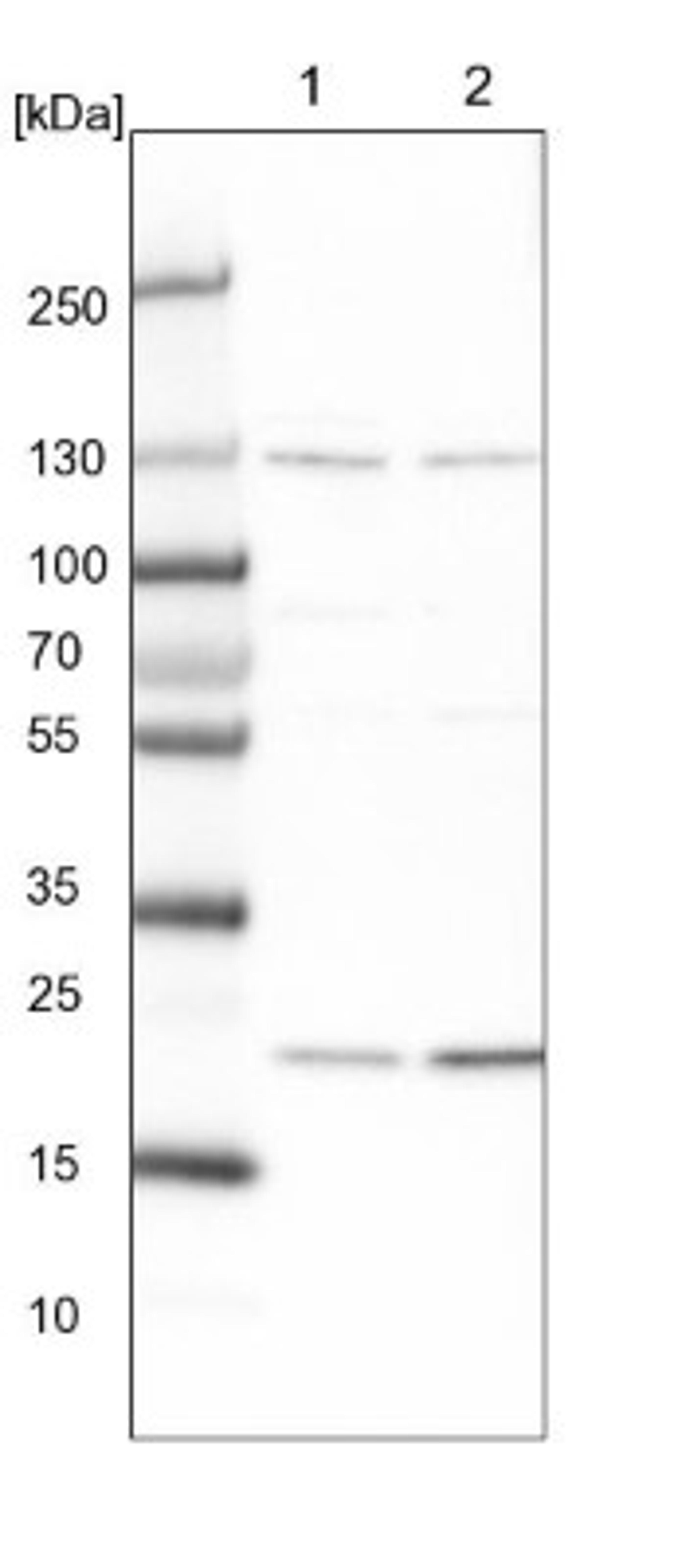 Western Blot: MED28 Antibody [NBP1-85104] - Lane 1: NIH-3T3 cell lysate (Mouse embryonic fibroblast cells)<br/>Lane 2: NBT-II cell lysate (Rat Wistar bladder tumour cells)