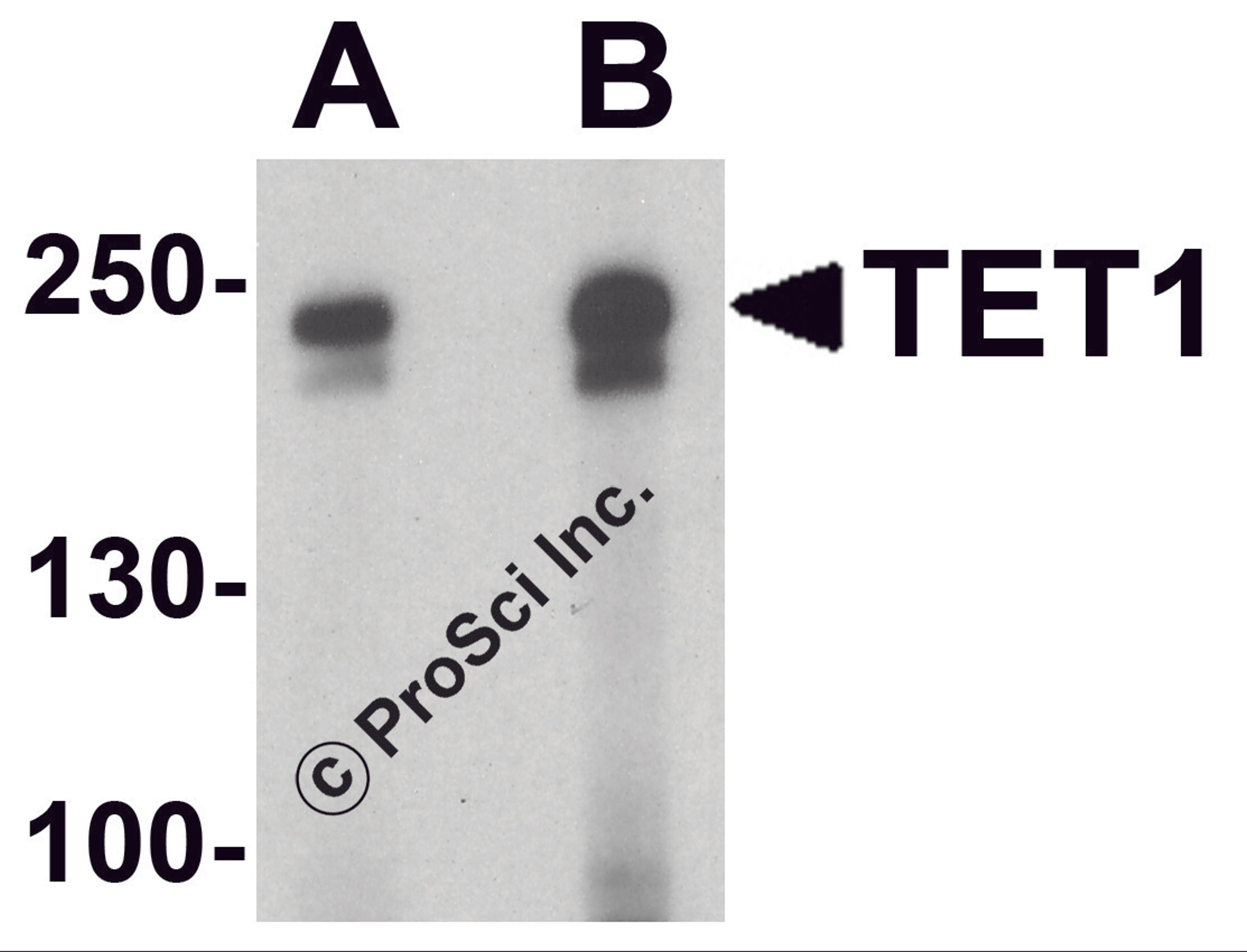 Western blot analysis of TET1 in rat brain tissue lysate with TET1 antibody at (A) 1 and (B) 2 μg/ml.