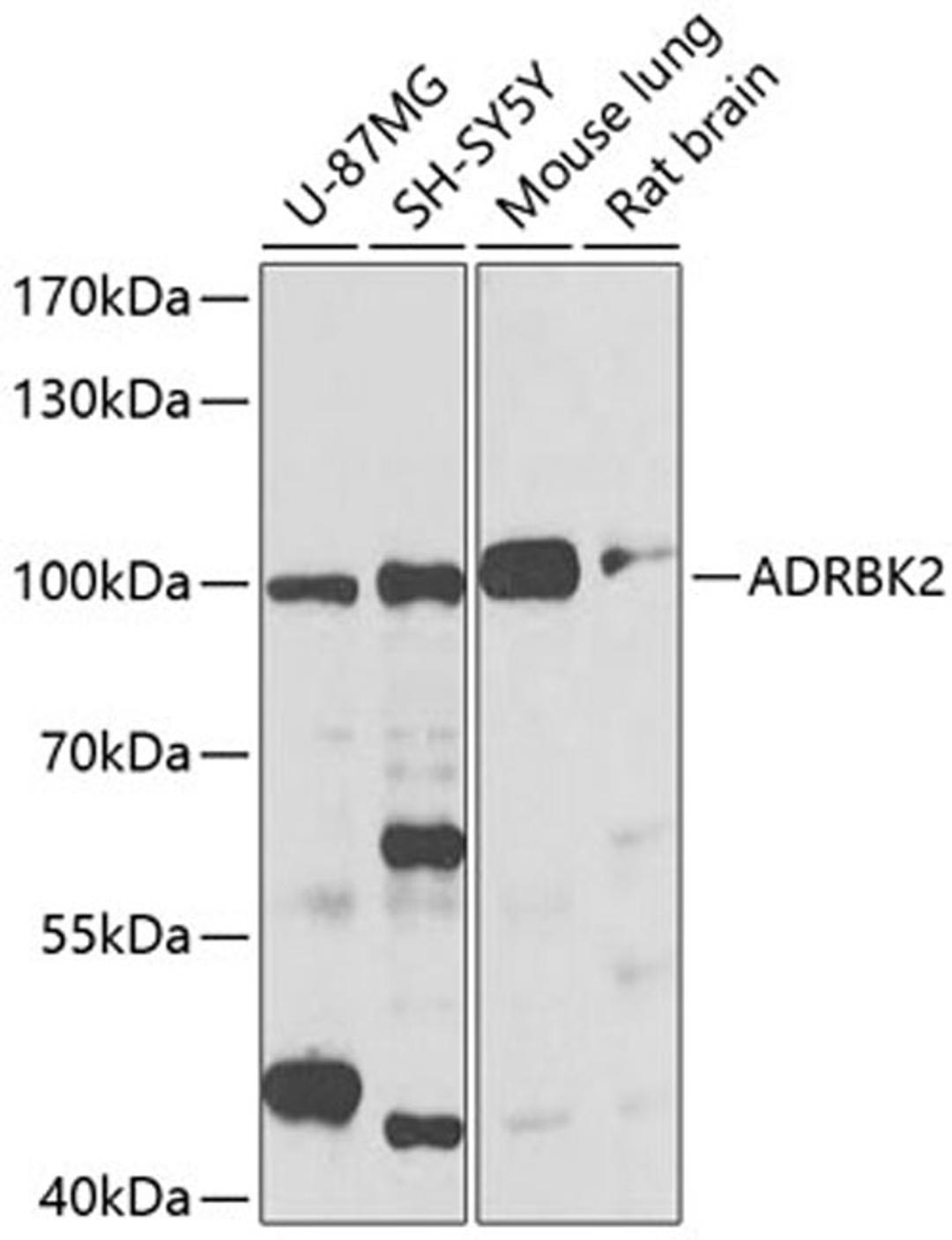 Western blot - ADRBK2 antibody (A2049)