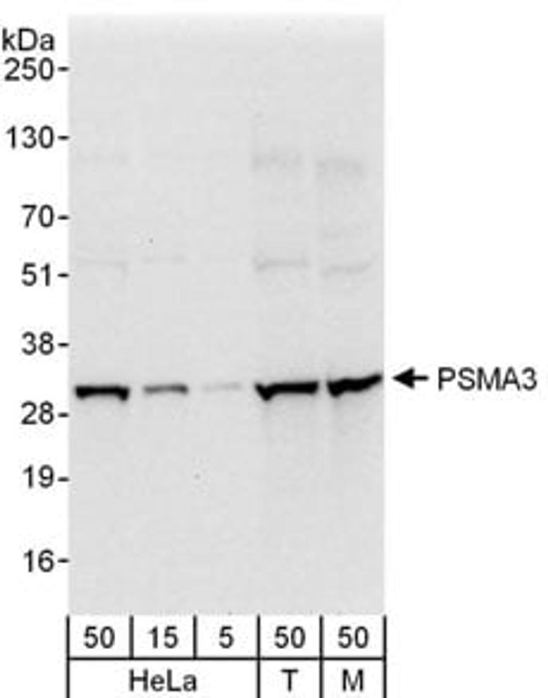 Detection of human and mouse PSMA3 by western blot.