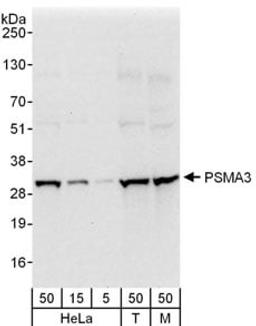 Detection of human and mouse PSMA3 by western blot.