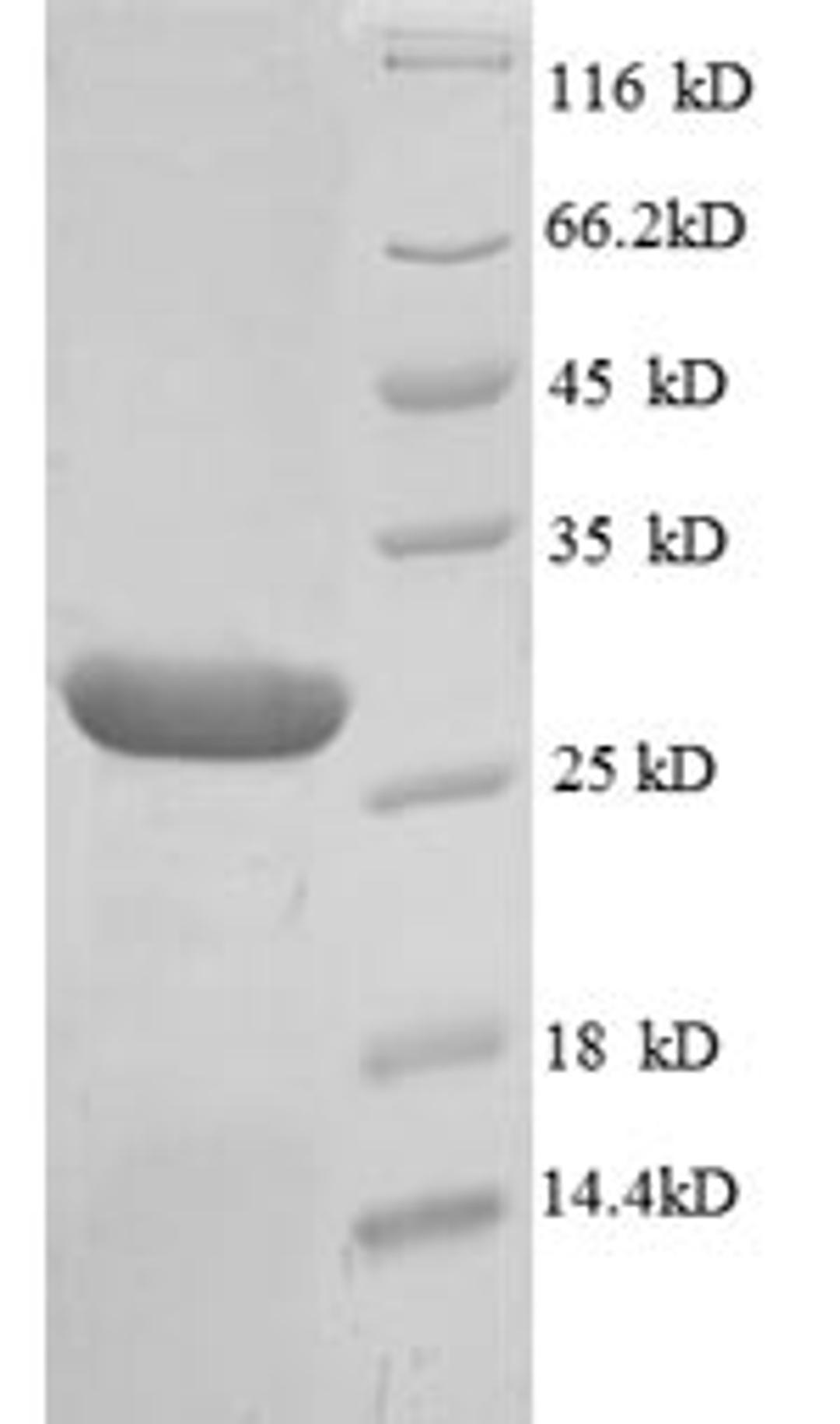 (Tris-Glycine gel) Discontinuous SDS-PAGE (reduced) with 5% enrichment gel and 15% separation gel.