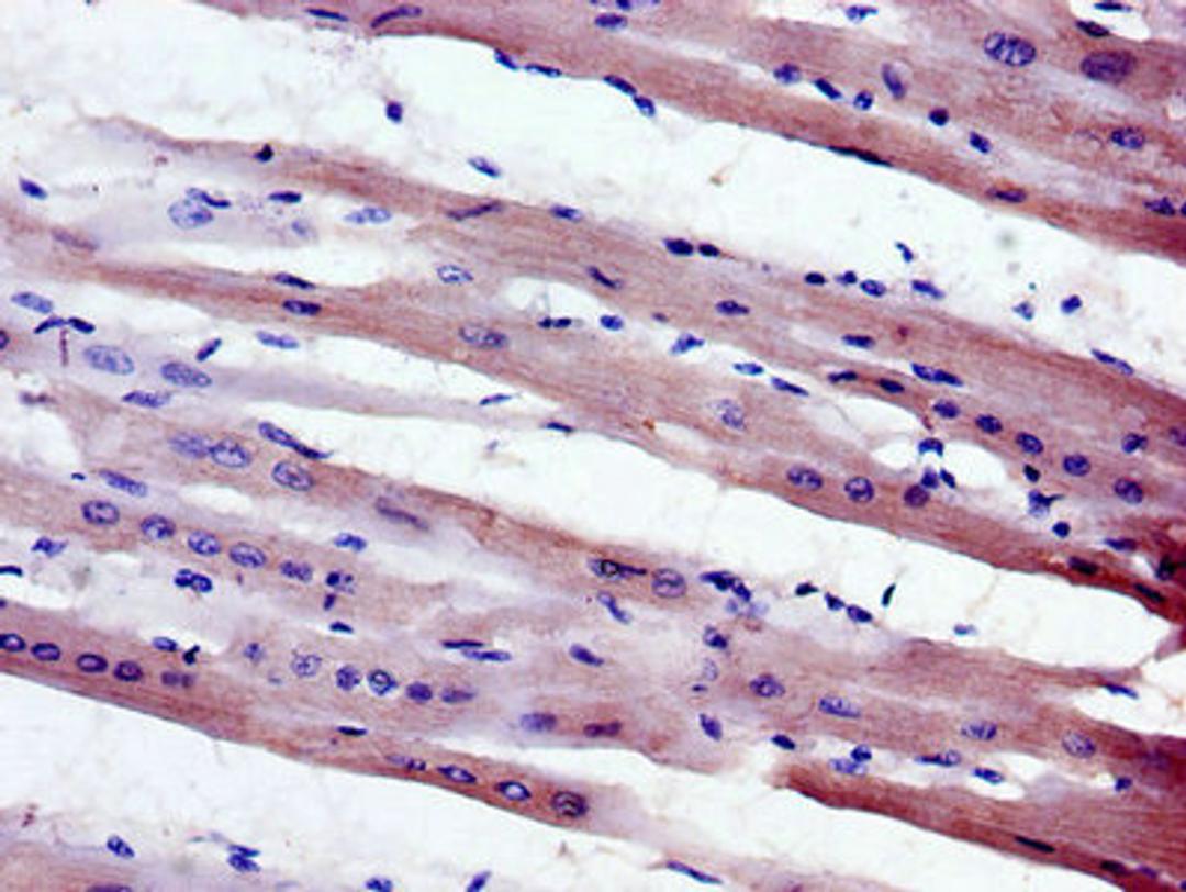 Immunohistochemistry of paraffin-embedded human heart tissue using CSB-PA014775LA01HU at dilution of 1:100