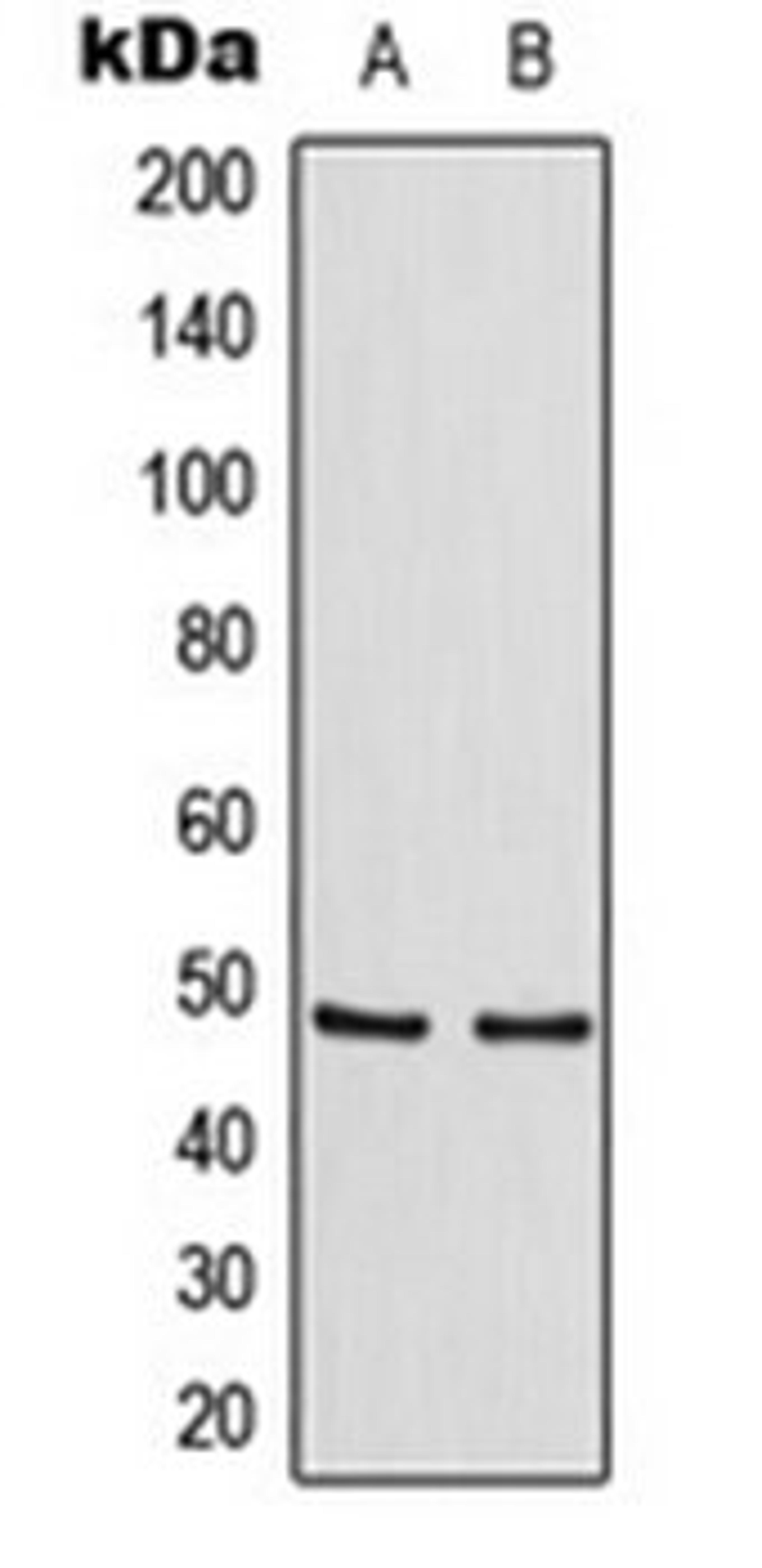 Western blot analysis of HeLa (Lane 1), Raw264.7 (Lane 2) whole cell lysates using TANK antibody