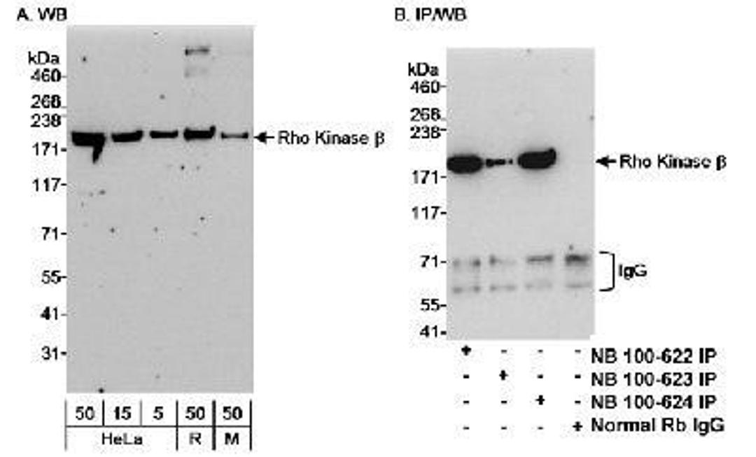 Western Blot: ROCK1 Antibody [NB100-624] - Detection of human and mouse Rho Kinase Beta (ROCK1/p160ROCK) on HeLa whole cell lysate using NB100-624. Rho Kinase Beta was also IPed using NB100-622 and NB100-623 at 3 ug/mg lysate.