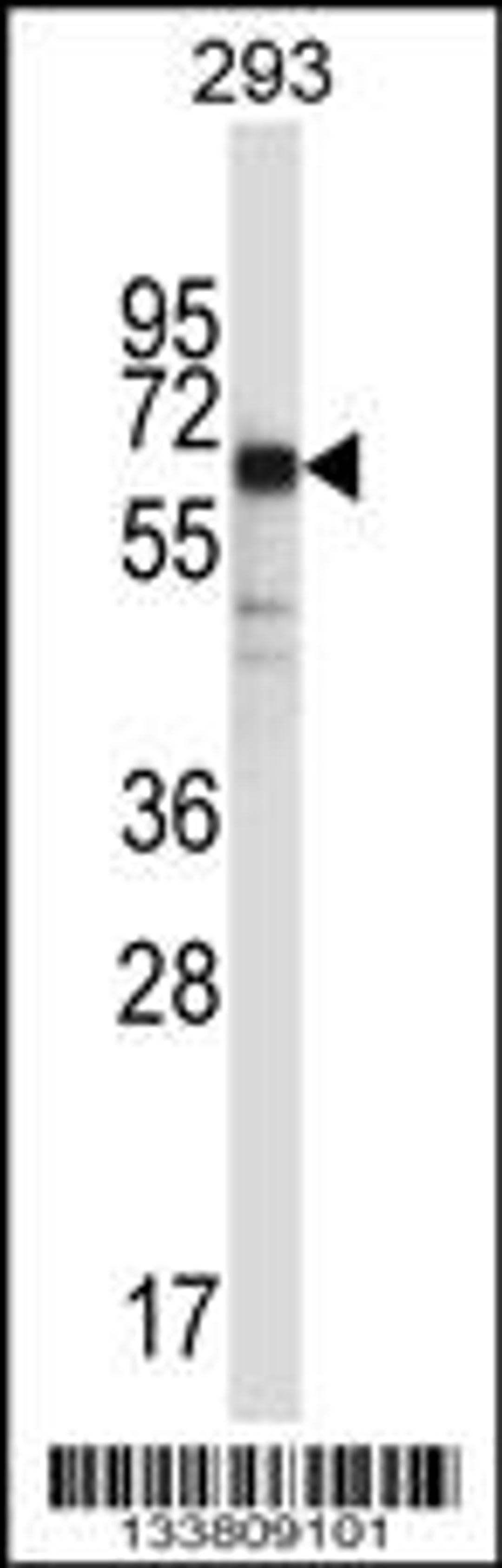 Western blot analysis in 293 cell line lysates (35ug/lane).