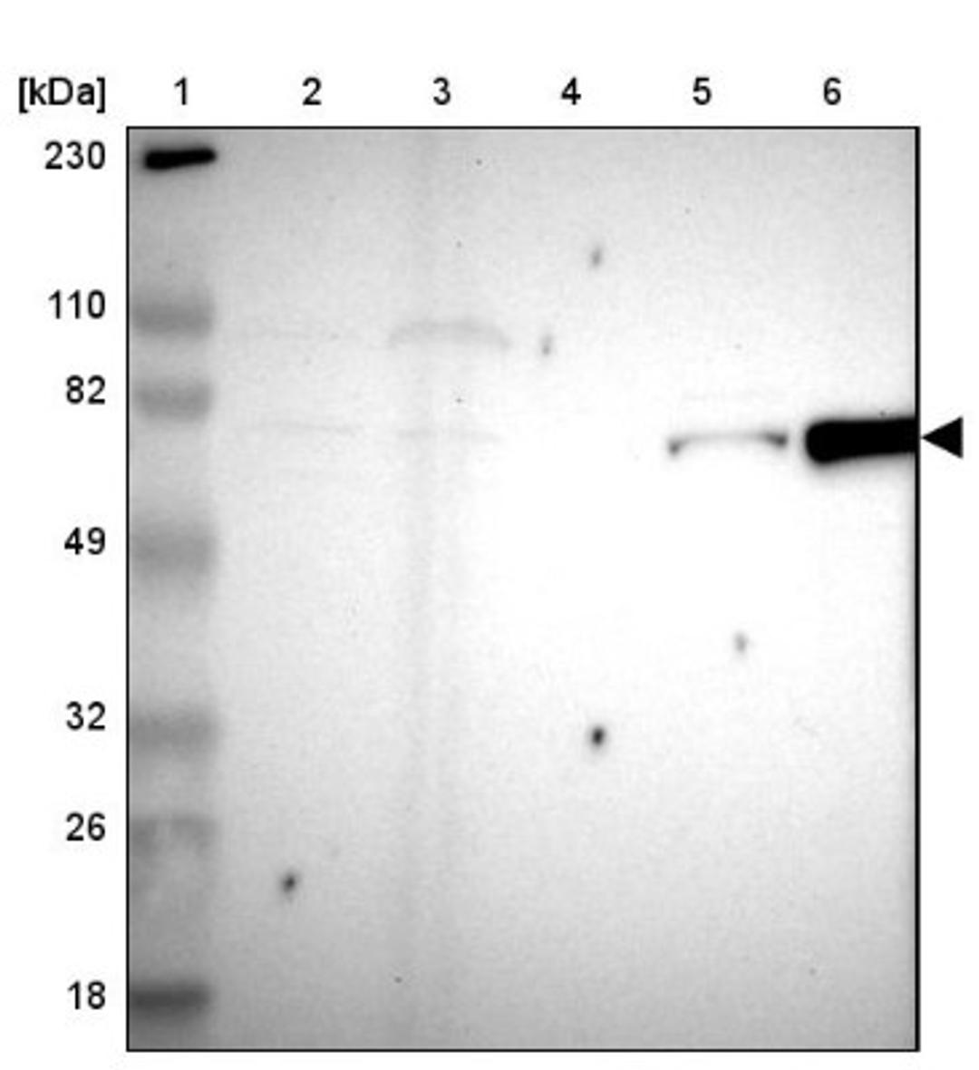 Western Blot: FSCB Antibody [NBP1-88417] - Lane 1: Marker [kDa] 230, 110, 82, 49, 32, 26, 18<br/>Lane 2: Human cell line RT-4<br/>Lane 3: Human cell line U-251MG sp<br/>Lane 4: Human plasma (IgG/HSA depleted)<br/>Lane 5: Human liver tissue<br/>Lane 6: Human tonsil tissue