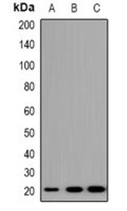 Western blot analysis of A549 (Lane1), NIH3T3 (Lane2), H9C2 (Lane3) whole cell lysates using TRAPPC5 antibody