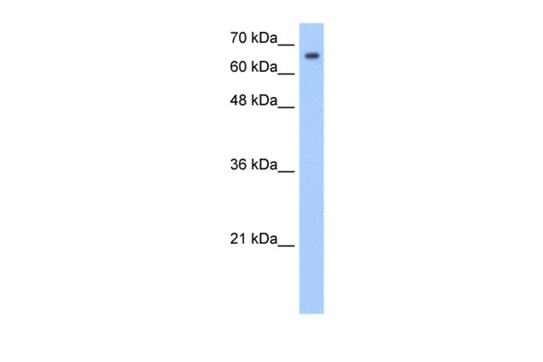 Antibody used in WB on Transfected 293T at 1.25 ug/ml.