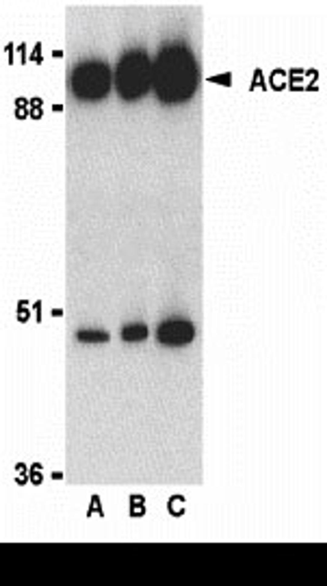 Western blot analysis of ACE2 in human kidney lysate with ACE2 antibody at 0.5 (lane A), 1 (lane B), and 2 (lane C) &#956;g/mL, respectively. 