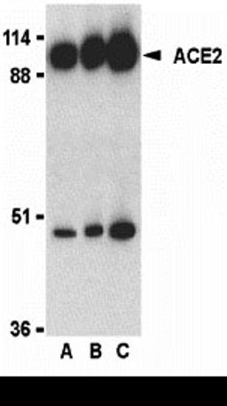 Western blot analysis of ACE2 in human kidney lysate with ACE2 antibody at 0.5 (lane A), 1 (lane B), and 2 (lane C) μg/mL, respectively.
