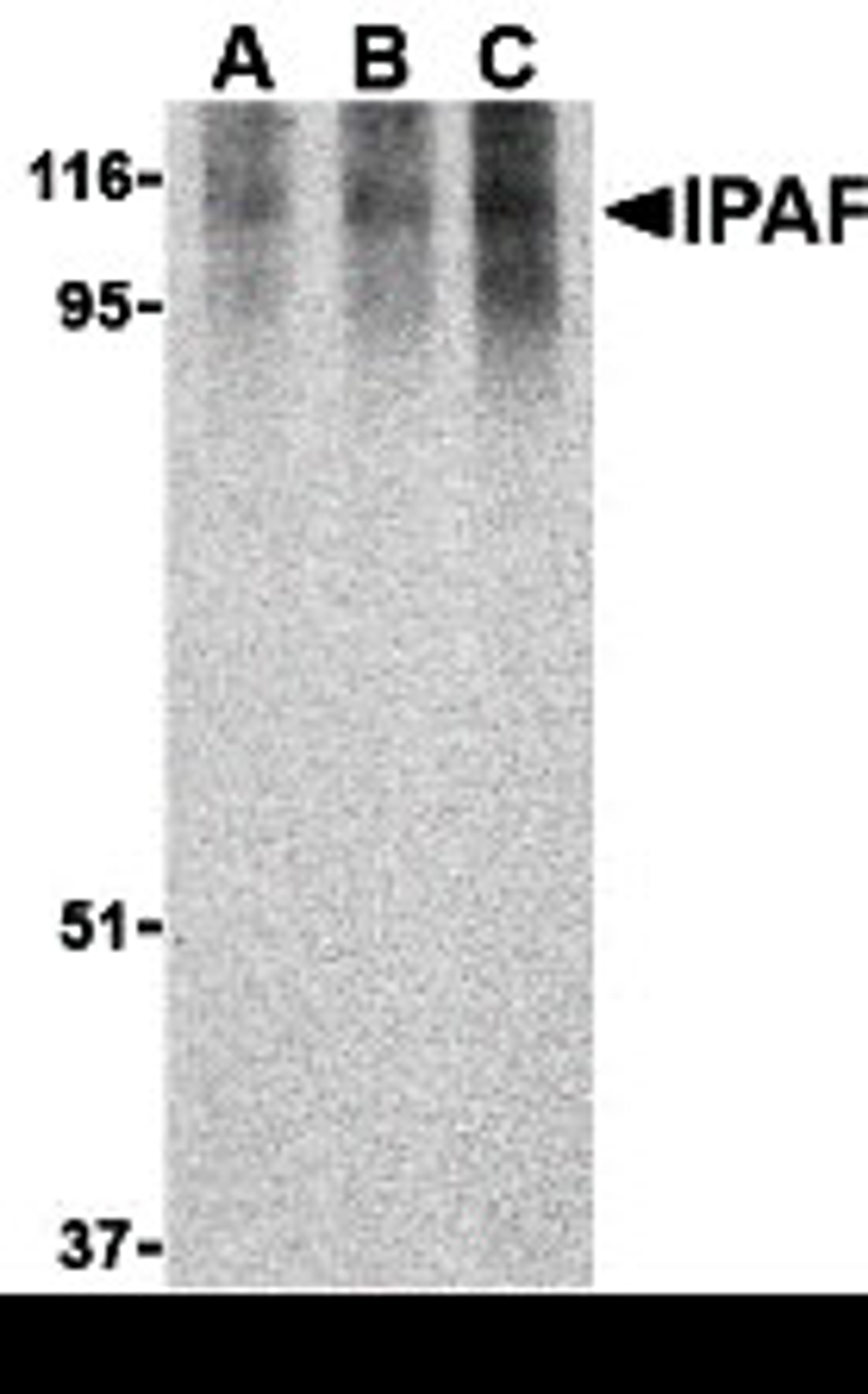 Western blot analysis of Ipaf in human PBL lysate with Ipaf antibody at 0.5 (lane A), 1 (lane B), and 2 (lane C) &#956;g/mL, respectively. 