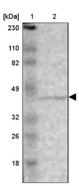 Western Blot: ZNF222 Antibody [NBP1-86148] - Lane 1: Marker [kDa] 230, 110, 82, 49, 32, 26, 18<br/>Lane 2: Human cell line RT-4