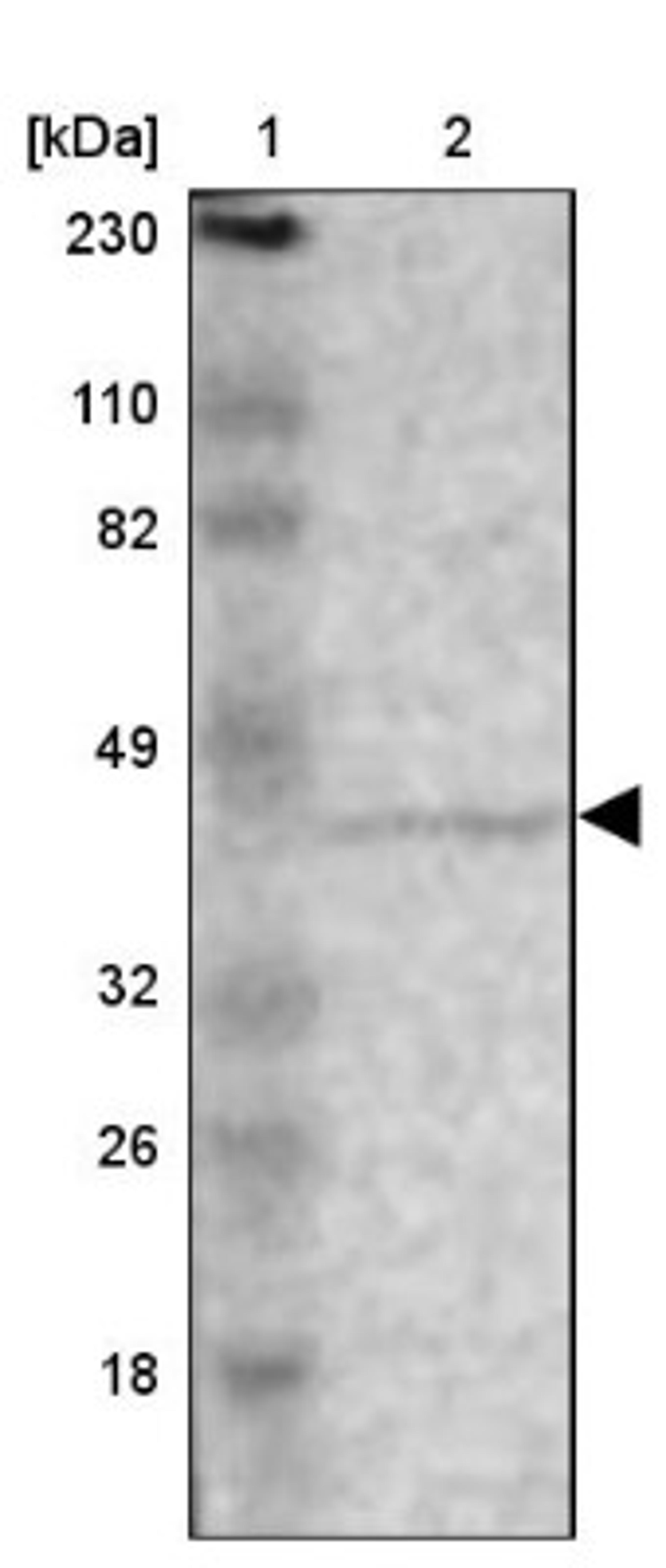 Western Blot: ZNF222 Antibody [NBP1-86148] - Lane 1: Marker [kDa] 230, 110, 82, 49, 32, 26, 18<br/>Lane 2: Human cell line RT-4