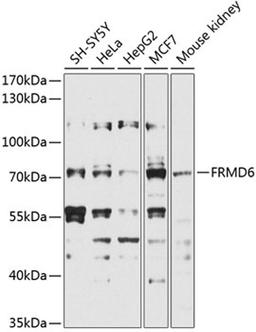 Western blot - FRMD6 antibody (A9995)