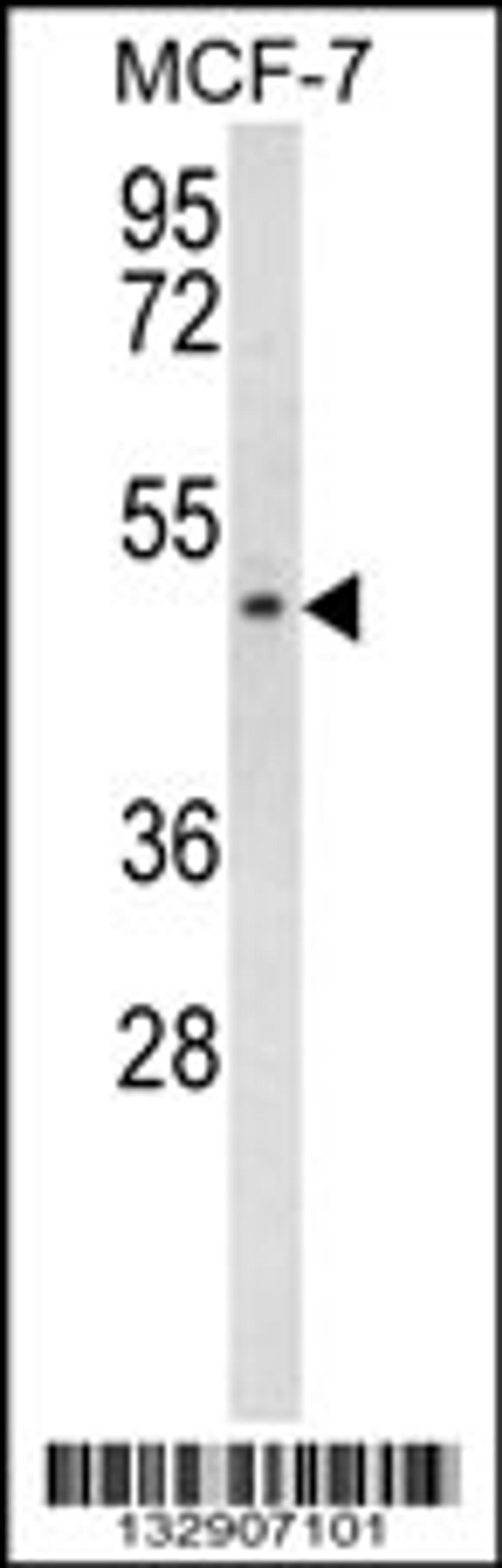 Western blot analysis in MCF-7 cell line lysates (35ug/lane).