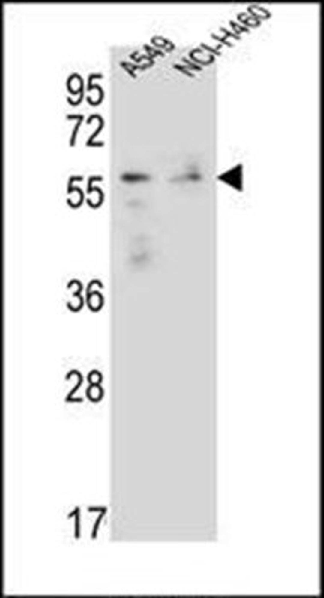 Western blot analysis of A549, NCI-H460 cell line lysates (35ug/lane) using FOXN1 antibody (Center)