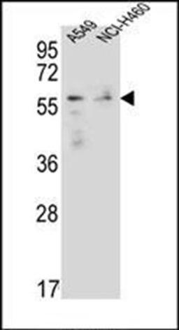 Western blot analysis of A549, NCI-H460 cell line lysates (35ug/lane) using FOXN1 antibody (Center)