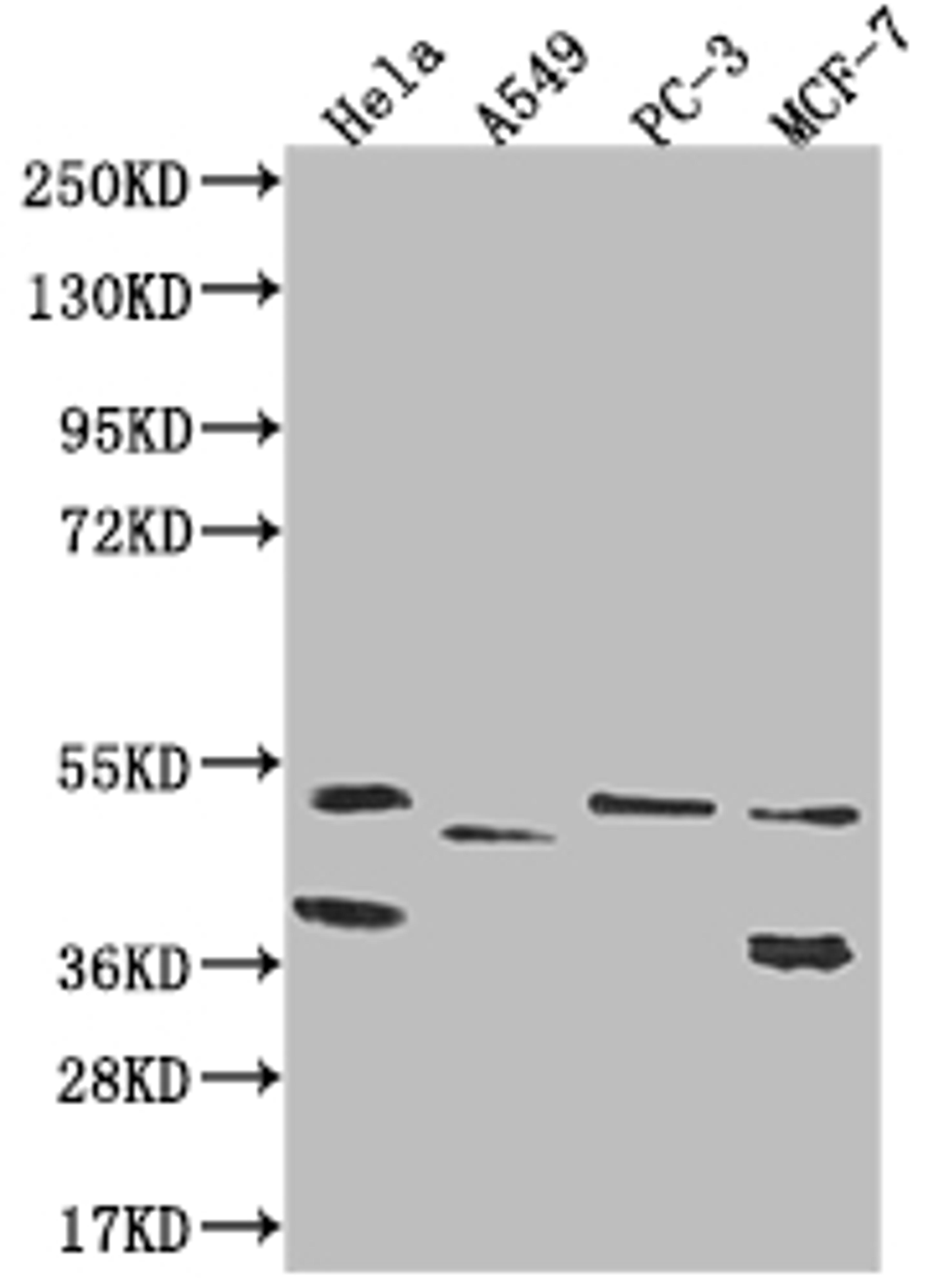 Western Blot. Positive WB detected in: Hela whole cell lysate, A549 whole cell lysate, PC-3 whole cell lysate, MCF-7 whole cell lysate. All lanes: PLEKHA1 antibody at 1:1000. Secondary. Goat polyclonal to rabbit IgG at 1/50000 dilution. Predicted band size: 46, 39 kDa. Observed band size: 36-55 kDa. 