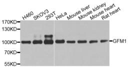 Western blot analysis of extracts of various cell lines using GFM1 antibody