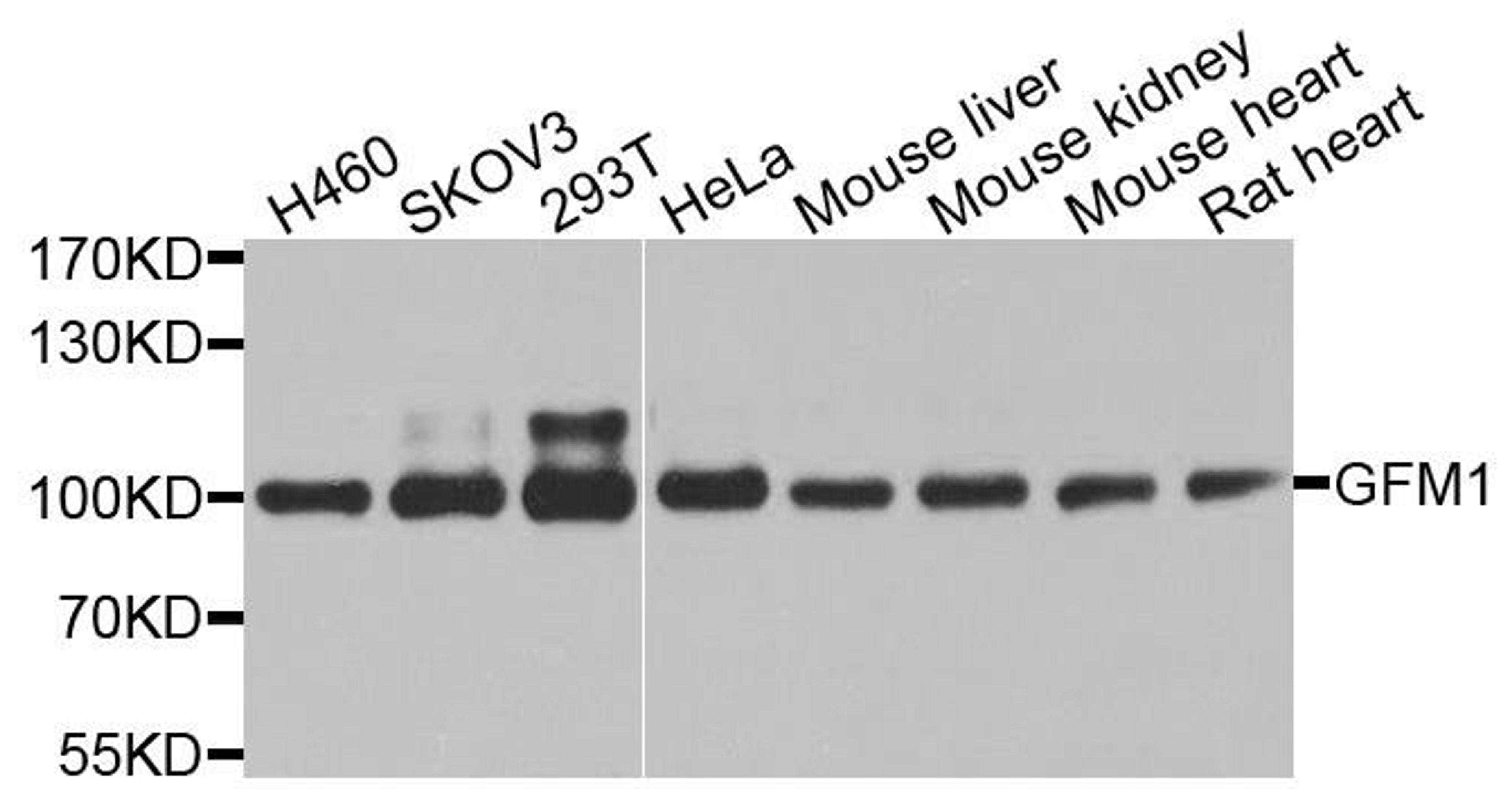 Western blot analysis of extracts of various cell lines using GFM1 antibody