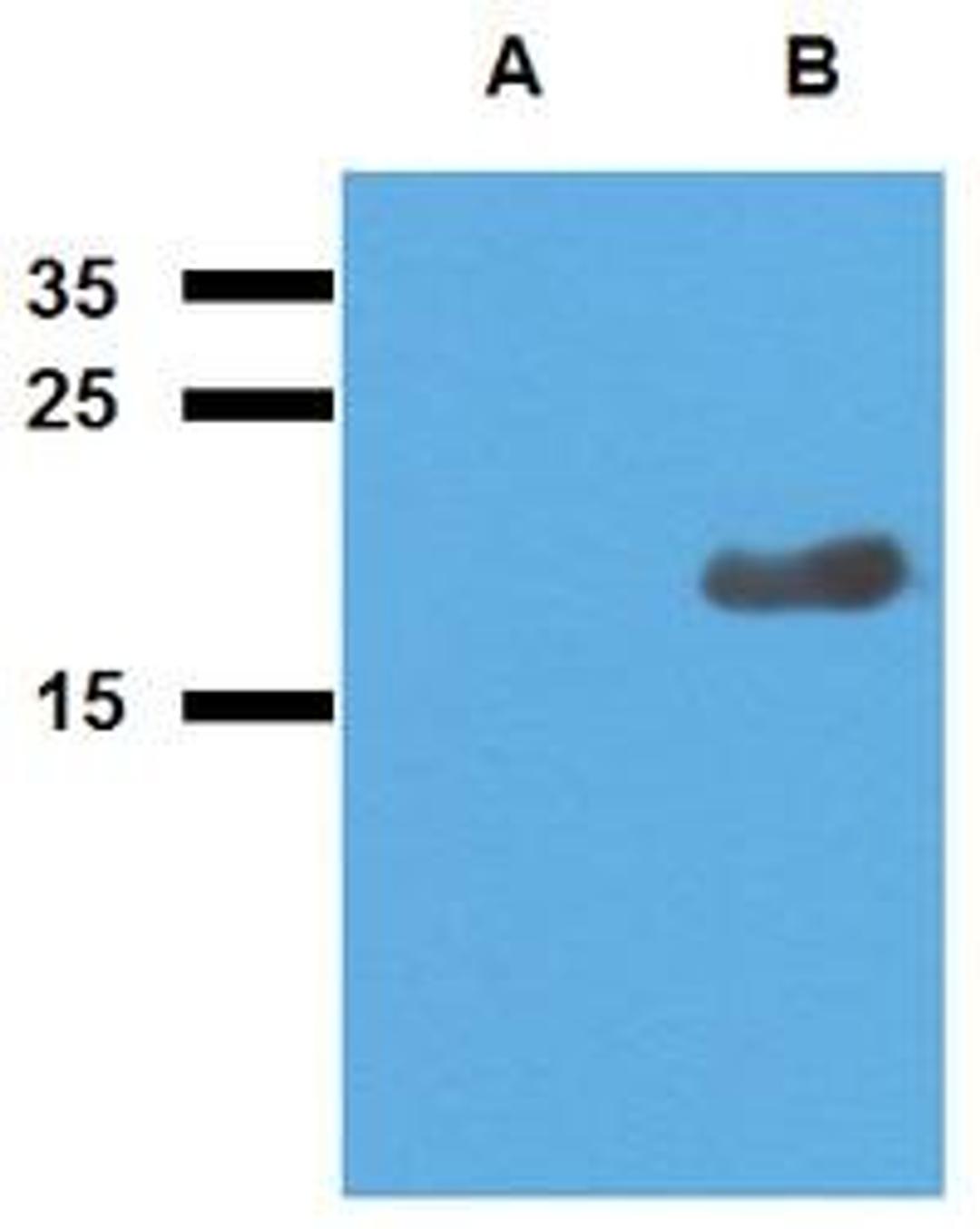 WB analysis of cell lysate of non-transfected E. coli (Lane1), cell lysate of Acr2-transfected E. coli (Lane2) using Acr2 antibody